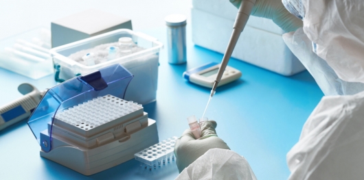 Estresse oxidativo, cobre e glutationa