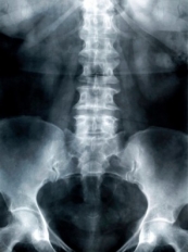 Hormônio derivado dos ossos suprime o apetite em camundongos.