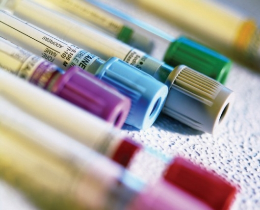 Importantes considerações na dosagem de citocinas no soro ou plasma.