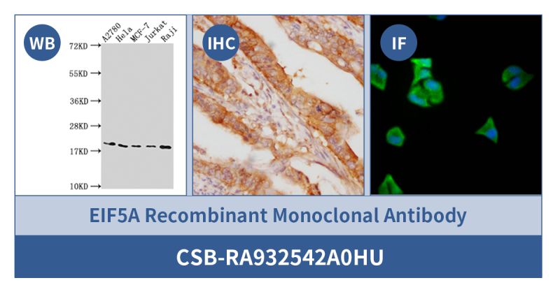 Lançamento de novo produto! Anticorpo monoclonal recombinante EIF5A
