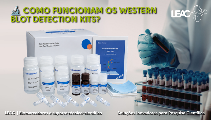 Fique por dentro das novidades com a Leac Lab | Como funcionam os Western Blot Detection Kits? 