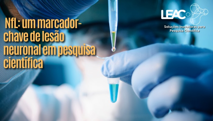 Fique por dentro das novidades com a Leac Lab | O que é NfL e por que ele importa? 