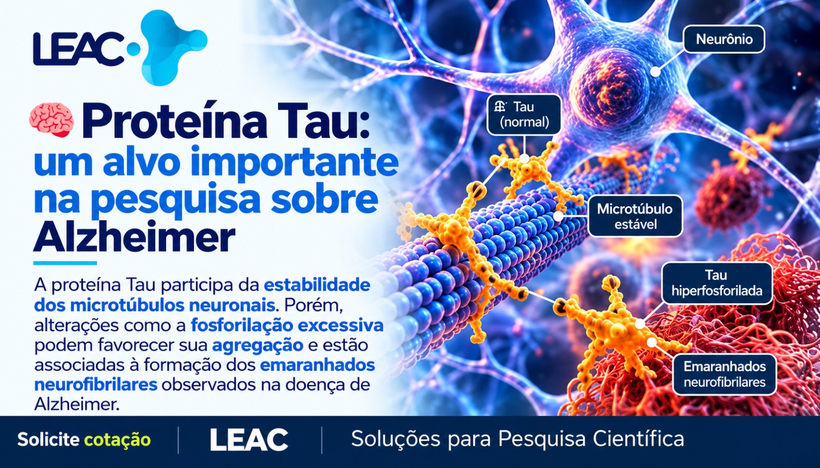 Fique por dentro das novidades com a Leac Lab | Proteína Tau: um alvo importante na pesquisa sobre a doença de Alzheimer 