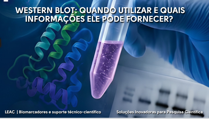 Fique por dentro das novidades com a Leac Lab | Western Blot: quando utilizar e quais informações ele pode fornecer? 