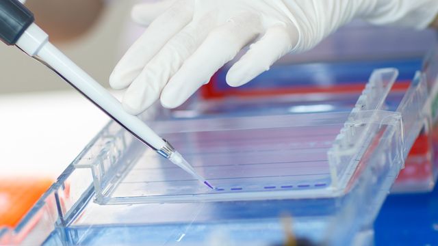 Western Blot | Leac Lab