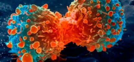 Pesquisadores descobrem as proteínas responsáveis pela metástase do câncer e como controlá-las.
