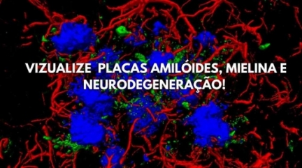 Reagentes de Rastreamento – Visualize os Caminhos das Doenças Neurodegenerativas!
